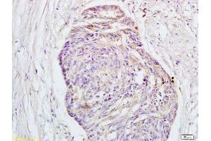 Immunohistochemistry (Paraffin-embedded Sections) (IHC (p)) image for anti-G Protein-Coupled Estrogen Receptor 1 (GPER) (AA 251-375) antibody (ABIN685717)