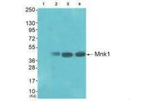 Western blot analysis of extracts from HepG2 cells (Lane 2), K562 cells (Lane 3) and Jurket cells (Lane 4), using Mnk1 (Ab-385) antiobdy. (MKNK1 抗体  (Thr385))