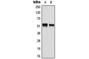 Western blot analysis of ATF2 (pS112) expression in HeLa (A), A549 (B) whole cell lysates. (ATF2 抗体  (pSer112))