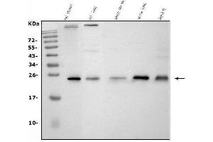 Western blot analysis of CD9 using anti-CD9 antibody (ABIN4886531). (CD9 抗体  (AA 110-193))