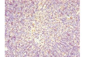 Immunohistochemistry of paraffin-embedded human thymus tissue using ABIN7147370 at dilution of 1:100 (Centromere Protein X (CENPX) (AA 1-63) 抗体)