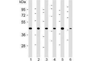 Western blot testing of 1) human 293, 2) (h) HeLa, 3) (h) MDA-MB-231, 4) rat H-4-II-E, 5) (h) HCT-116 and 6) mouse C2C12 cell lysate with TBP antibody at 1:2000. (TBP 抗体)