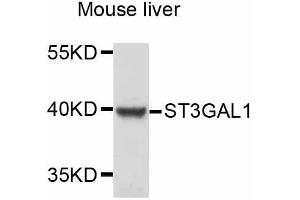 Western blot analysis of extracts of mouse liver, using ST3GAL1 antibody (ABIN5998972) at 1:3000 dilution.