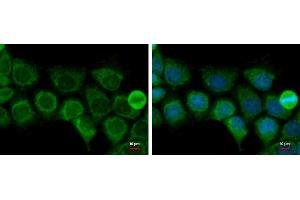ICC/IF Image ACAT1 antibody [N1N3] detects ACAT1 protein at mitochondria by immunofluorescent analysis.