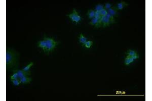 Immunofluorescence of monoclonal antibody to MCAM on JAR cell . (MCAM 抗体  (AA 24-646))