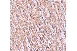 Immunohistochemistry (IHC) image for anti-Solute Carrier Family 39 (Zinc Transporter), Member 9 (SLC39A9) (N-Term) antibody (ABIN1031684) (SLC39A9 抗体  (N-Term))