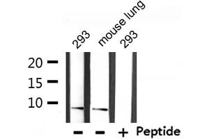 Western blot analysis of extracts from 293 and mouse lung, using Ubiquitin Antibody. (UBA52 抗体  (Internal Region))