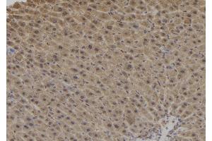 ABIN6276878 at 1/100 staining Mouse liver tissue by IHC-P. (Dynactin 1 抗体  (C-Term))
