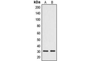 Western blot analysis of CTDSP1 expression in Jurkat (A), HuvEc (B) whole cell lysates.