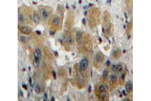 Used in DAB staining on fromalin fixed paraffin-embedded Liver tissue (CA1 抗体  (AA 2-261))