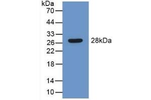 Detection of Recombinant LEI, Mouse using Polyclonal Antibody to Leukocyte Elastase Inhibitor (LEI) (SERPINB1 抗体  (AA 184-368))