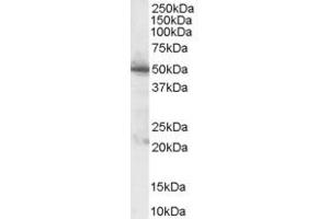 ABIN185389 (1µg/ml) staining of Human Pancreas lysate (35µg protein in RIPA buffer). (PDHX 抗体  (C-Term))