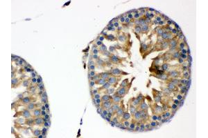 Immunohistochemistry (IHC) image for anti-Clock Homolog (Mouse) (CLOCK) (AA 75-109), (N-Term) antibody (ABIN3043813)