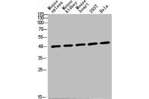 Western Blot analysis of various cells using Antibody diluted at 1:1000. (CD72 抗体  (Internal Region))