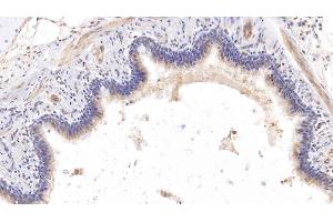 Immunohistochemistry (IHC) image for anti-Collagen, Type VIII, alpha 1 (COL8A1) (AA 575-743) antibody (ABIN7426484)