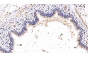 Detection of COL8a1 in Human Lung Tissue using Monoclonal Antibody to Collagen Type VIII Alpha 1 (COL8a1) (COL8A1 抗体  (AA 575-743))