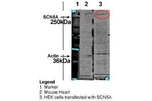 WB Suggested Anti-SCN5A Antibody Titration: HEK cel lysate; HEK cel with HuNav1. (SCN5A 抗体  (C-Term))
