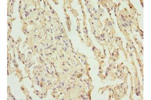 Immunohistochemistry of paraffin-embedded human lung tissue using ABIN7147382 at dilution of 1:100 (Precursor of CEP12 (AT1G31670) (AA 1-270) 抗体)