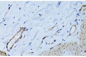 Immunohistochemistry of paraffin-embedded Human colon using MCAM Polyclonal Antibody at dilution of 1:100 (40x lens). (MCAM 抗体)