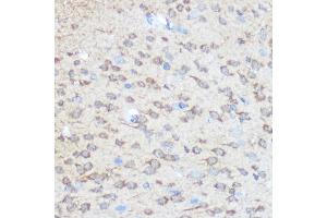 Immunohistochemistry of paraffin-embedded rat brain using Huntingtin Rabbit pAb (ABIN7267794) at dilution of 1:100 (40x lens). (Huntingtin 抗体)
