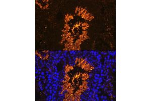 Immunofluorescence analysis of Mouse testis using  antibody (ABIN7265353) at dilution of 1:100. (AKAP4 抗体  (AA 189-340))