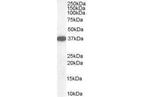 Image no. 1 for anti-Dimethylarginine Dimethylaminohydrolase 1 (DDAH1) (C-Term) antibody (ABIN374149) (DDAH1 抗体  (C-Term))