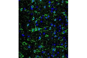 Immunofluorescent staining of brain tissue reacted with MAP2 monoclonal antibody  at 1:10-1:50 dilution.