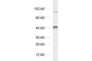 dilution: 1 : 5000, sample: rat brain homogenate (Cytohesin 2 抗体)