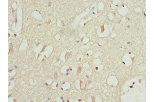 Immunohistochemistry of paraffin-embedded human brain tissue using ABIN7164274 at dilution of 1:100 (PITRM1 抗体  (AA 758-1037))