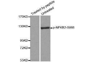 Western blot analysis of extracts from ovary cancer cells, using Phospho-NFKB2-S866 antibody (ABIN2988214). (NFKB2 抗体  (pSer866))