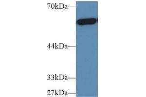 Western Blotting (WB) image for anti-Pyruvate Kinase M2 (PKM2) (AA 141-248) antibody (ABIN7432133)