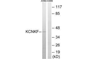 Western blot analysis of extracts from A549 cells, using KCNK15 antibody. (KCNK15 抗体  (C-Term))