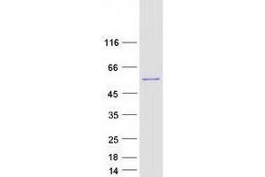 UDP-Glucose Pyrophosphorylase 2 (UGP2) (Transcript Variant 2) protein (Myc-DYKDDDDK Tag)