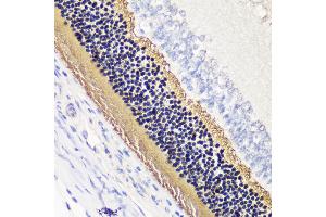 Immunohistochemistry of paraffin-embedded rat retina using PDC antibody (ABIN7269269) at dilution of 1:200 (40x lens). (Phosducin 抗体  (AA 1-246))