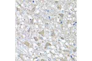 Immunohistochemistry of paraffin-embedded rat brain using VPS37A antibody. (VPS37A 抗体  (AA 224-397))