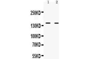 Observed bind size: 150KD (NRIP1 抗体  (N-Term))