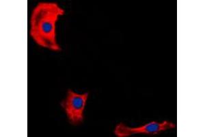 Immunofluorescent analysis of Fibulin 4 staining in HepG2 cells. (FBLN4 抗体  (Center))