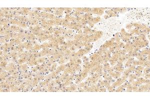 Detection of ANG in Human Liver Tissue using Monoclonal Antibody to Angiogenin (ANG) (ANG 抗体  (AA 25-147))