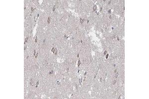 ABIN6266661 at 1/100 staining human brain tissue sections by IHC-P. (SUMO1 抗体  (N-Term))