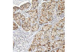 IHC analysis of ALDOA using anti-ALDOA antibody (ABIN7601907). (ALDOA 抗体  (AA 50-364))