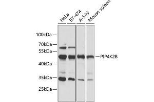 Western blot analysis of extracts of various cell lines, using PIP4K2B antibody (ABIN6130646, ABIN6145675, ABIN6145677 and ABIN6216199) at 1:1000 dilution. (PIP4K2B 抗体  (AA 1-270))