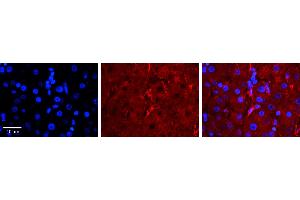 LBP antibody - C-terminal region          Formalin Fixed Paraffin Embedded Tissue:  Human Liver Tissue    Observed Staining:  Cell membrane in endothelial cell in sinusoids   Primary Antibody Concentration:  1:100    Other Working Concentrations:  1/600    Secondary Antibody:  Donkey anti-Rabbit-Cy3    Secondary Antibody Concentration:  1:200    Magnification:  20X    Exposure Time:  0. (LBP 抗体  (C-Term))