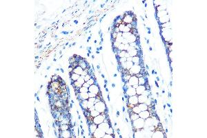 Immunohistochemistry of paraffin-embedded human colon using SFRP4 Rabbit mAb (ABIN7270180) at dilution of 1:100 (40x lens). (SFRP4 抗体)