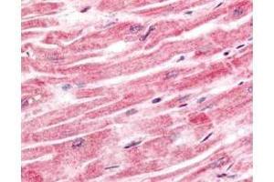 Immunohistochemistry of Rabbit anti-Sprouty-4 antibody. (SPRY4 抗体  (AA 275-299))
