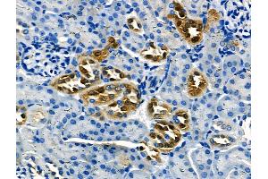 ABIN6264652 and ABIN6266628 at 1/100 staining Mouse kidney tissue by IHC-P. (RASH/RASK/RASN (N-Term) 抗体)