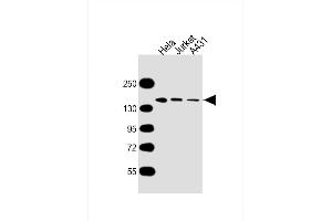 All lanes : Anti-MYBBP1A Antibody at 1:5000 dilution Lane 1: Hela whole cell lysate Lane 2: Jurkat whole cell lysate Lane 3: A431 whole cell lysate Lysates/proteins at 20 μg per lane. (MYBBP1A 抗体  (AA 1104-1328))