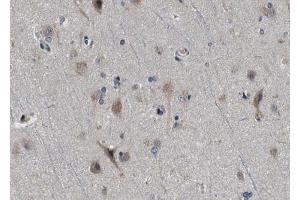 ABIN6272994 at 1/100 staining human brain tissue sections by IHC-P. (CPT1C 抗体)
