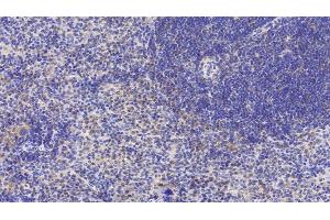 Detection of LY96 in Mouse Spleen Tissue using Polyclonal Antibody to Lymphocyte Antigen 96 (LY96) (LY96 抗体  (AA 16-160))