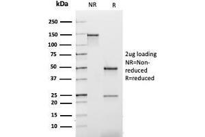 SDS-PAGE Analysis Purified Kappa Light Chain Mouse Recombinant Monoclonal Ab (rL1C1). (Recombinant IGKC 抗体)