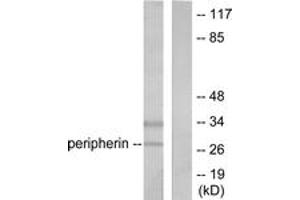 Western blot analysis of extracts from 293 cells, using PGP9. (UCHL1 抗体  (AA 171-220))